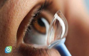 لنز-اسکلرال-برای-چه-کسانی-استفاده-می-شود-کلینیک-چشم-دیدار