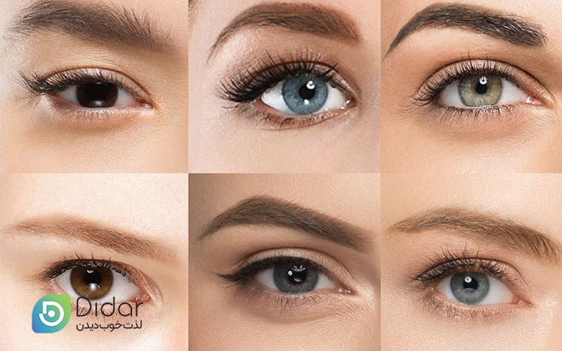 تشخیص-فرم-و-شکل-چشم-کلنیک-چشم-دیدار