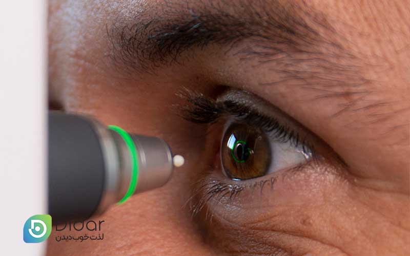علائم-وجود-فشار-چشم-چیست-کلینیک-چشم-دیدار