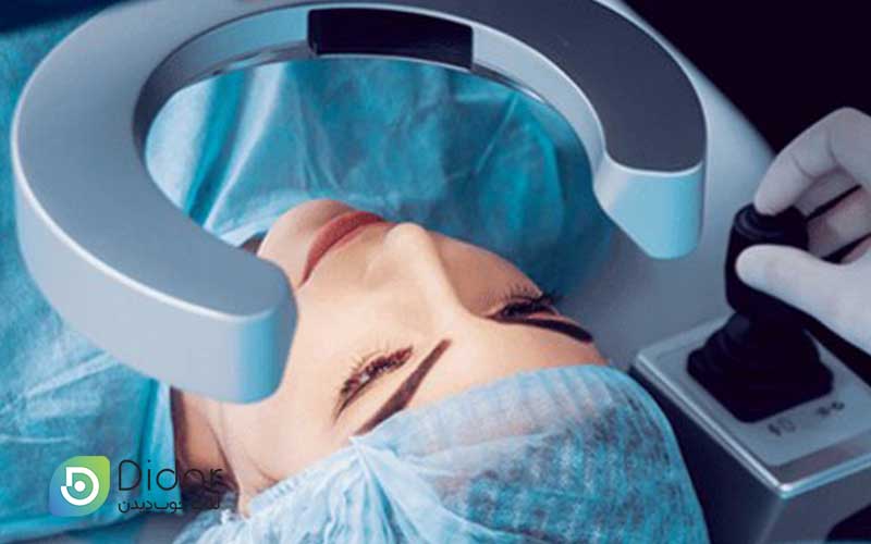 عمل-لازک-چشم-(PRK)-چقدر-طول-می-کشد-کلینیک-چشم-دیدار