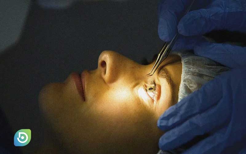 عمل-لازک-چشم-یا-PRK-چگونه-است-مزایا-و-عوارض-لازک-چشم-کلینیک-چشم-دیدار