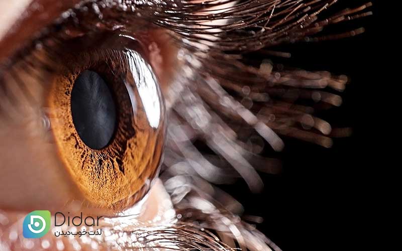 قرنیه-چیست-و-چرا-از-اهمیت-بالایی-برخودار-است