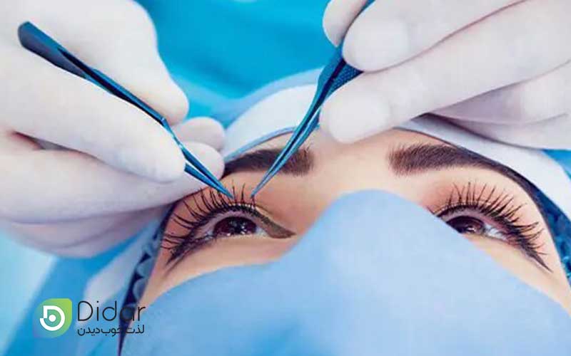 عمل-چشم-اسمایل-چیست؟-آشنایی-با-نحوه-عمل-ریلکس-اسمایل-چشم
