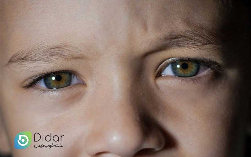 بیماری رتینوبلاستوما چیست؟